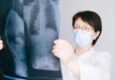 Złamanie kości – objawy, diagnostyka, leczenie i powrót do treningu
